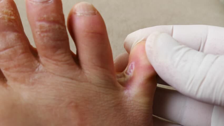 Mushrooms between fingers