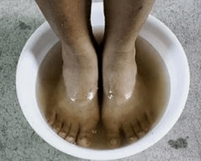 Treatment of nail fungi