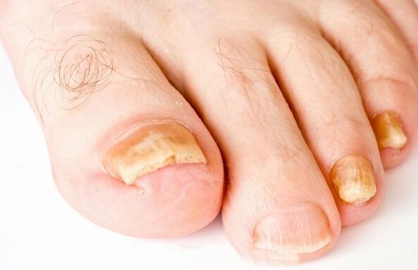 Nail trunk