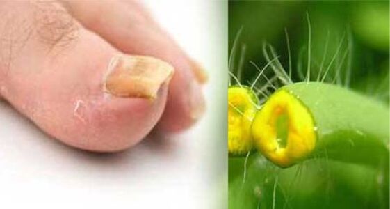 Celandine herb for nail fungus