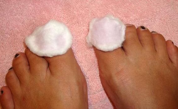 Compress to treat toenail fungus