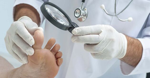 After diagnosing the disease, the doctor will prescribe a remedy for nail fungus