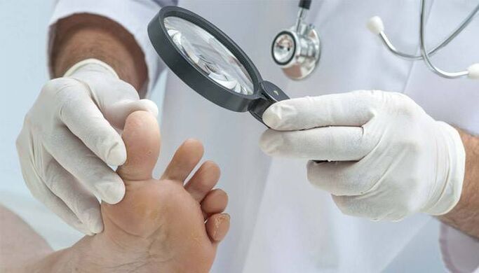 examination of the feet for fungus between the toes