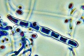 nail fungus pathogen under the microscope