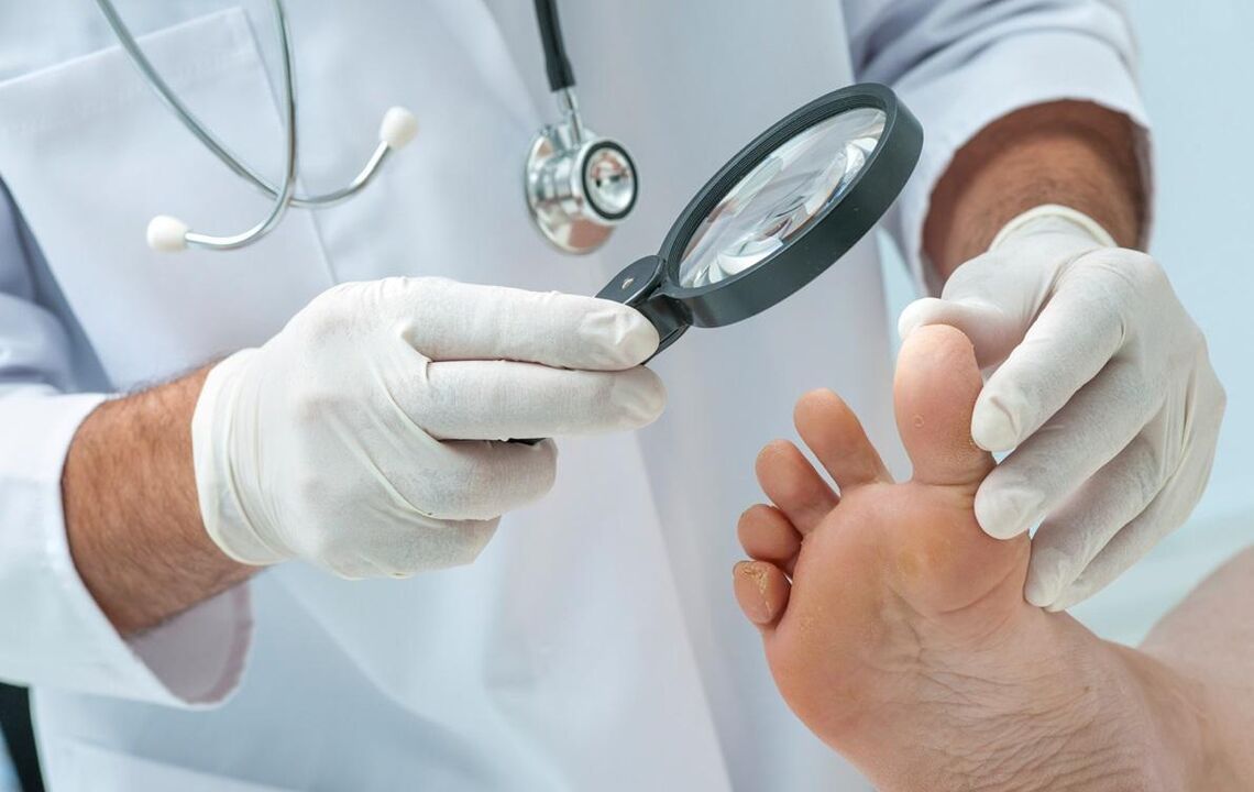 the doctor checks the nails for fungus